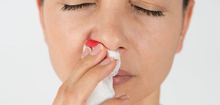 how-prevent-winter-nosebleeds